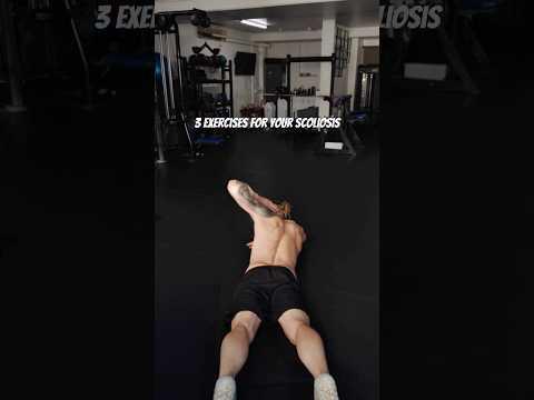 Bài tập giảm đau cho người bị vẹo cột sống