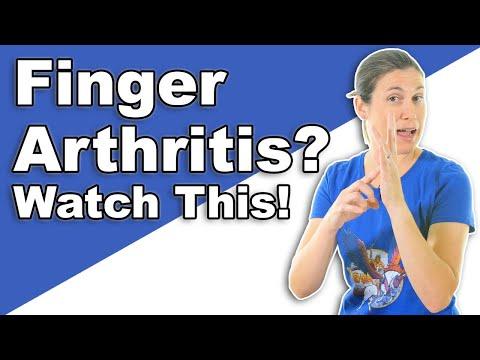 Giảm Đau Viêm Khớp Ngón Tay: Mẹo Hiệu Quả!