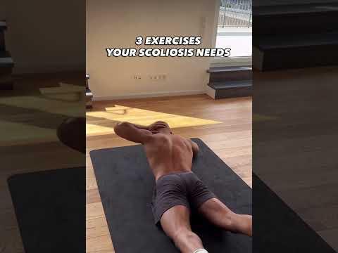 Bài tập cho người bị scoliosis