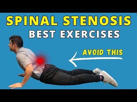 Bài tập giảm đau cho hẹp ống sống