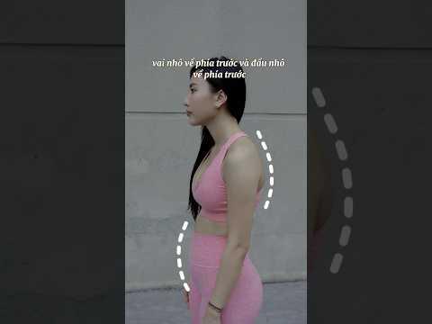 Bài tập cải thiện gù lưng và cổ rùa