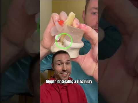 Cách Khắc Phục Thoát Vị Đĩa Đệm Không Cần Phẫu Thuật