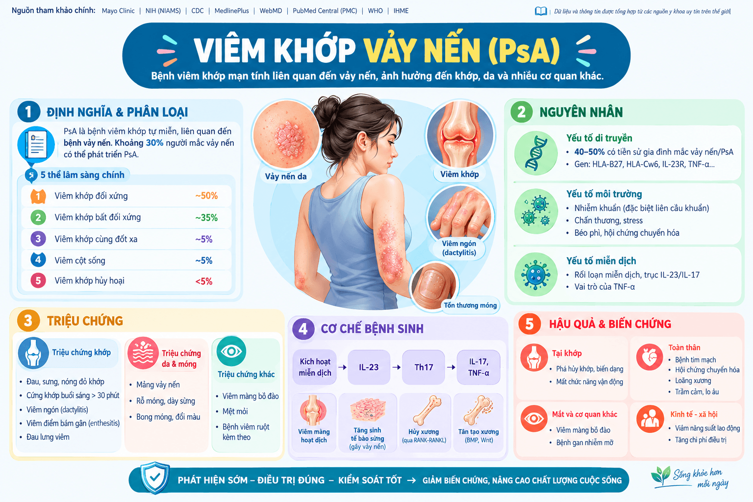 Viêm khớp vảy nến (Psoriatic Arthritis – PsA)