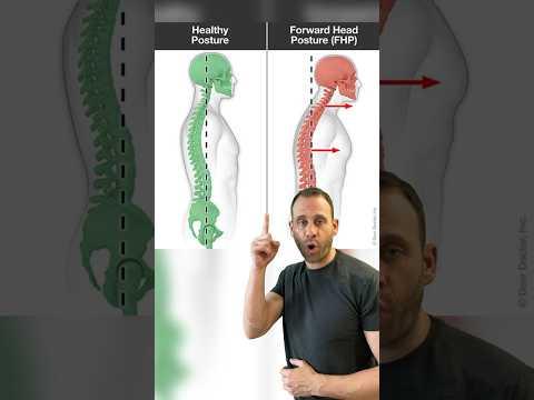 Khắc phục tư thế đầu nghiêng về phía trước