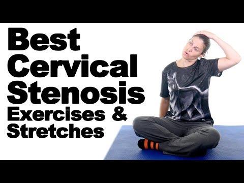 Bài tập giãn cơ cho người bị hẹp ống sống cổ